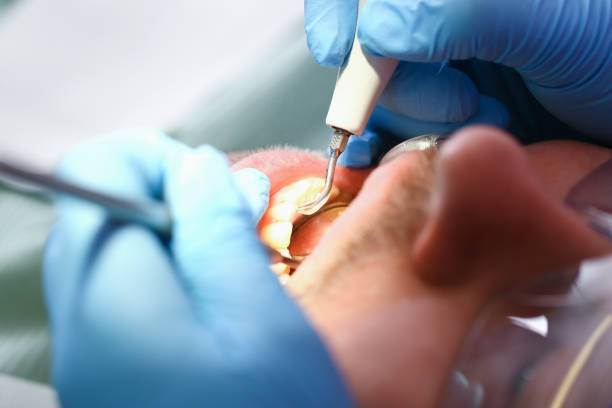 Best Weekend Emergency Dentist in Goodland, IN